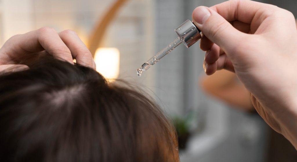 Minoxidil femme : efficacité, effets secondaires et alternatives naturelles